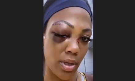 Former Olympian, Kim Glass attacked by homeless man
